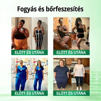 🤍 KKIO® 20 az 1-ben Glumasetide Fit & Vital mikrotűs tapasz - 7 napon belül látható változás / Alkalmas elhízás, szív- és érrendszeri egészség, cukorbetegség, alvási apnoé, bélrendszeri egészség, ízületi problémák és számos egyéb állapot esetén.