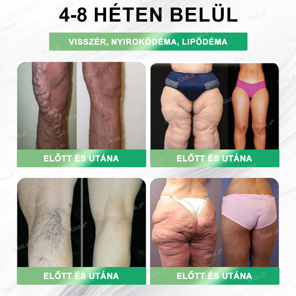 ⭐𝑲𝒂𝒂𝑳𝒂® 𝑮𝑳𝑷-1 8 𝒂𝒛 1-𝒃𝒆𝒏 𝑭𝒊𝒕 & 𝑽𝒊𝒕𝒂𝒍 𝑺𝒛á𝒋𝒐𝒏 á𝒕 𝒔𝒛𝒆𝒅𝒉𝒆𝒕ő 𝒐𝒍𝒅𝒂𝒕 – 𝑵𝒂𝒑𝒊 𝒆𝒈𝒚𝒔𝒛𝒆𝒓, 7 𝒏𝒂𝒑 𝒂𝒍𝒂𝒕𝒕 𝒍á𝒕𝒉𝒂𝒕ó 𝒗á𝒍𝒕𝒐𝒛á𝒔 / 𝑬𝒍𝒉í𝒛á𝒔, 𝒔𝒛í𝒗- é𝒔 é𝒓𝒓𝒆𝒏𝒅𝒔𝒛𝒆𝒓𝒊 𝒆𝒈é𝒔𝒛𝒔é𝒈, 𝒄𝒖𝒌𝒐𝒓𝒃𝒆𝒕𝒆𝒈𝒔é𝒈, 𝒂𝒍𝒗á𝒔𝒊 𝒂𝒑𝒏𝒐𝒆, 𝒃é𝒍𝒓𝒆𝒏𝒅𝒔𝒛𝒆𝒓 𝒆𝒈é𝒔𝒛𝒔é𝒈𝒆, í𝒛ü𝒍𝒆𝒕𝒊 𝒑𝒓𝒐𝒃𝒍é𝒎á𝒌 é𝒔 𝒎é𝒈 𝒔𝒐𝒌 𝒎á𝒔 𝒆𝒔𝒆𝒕é𝒏