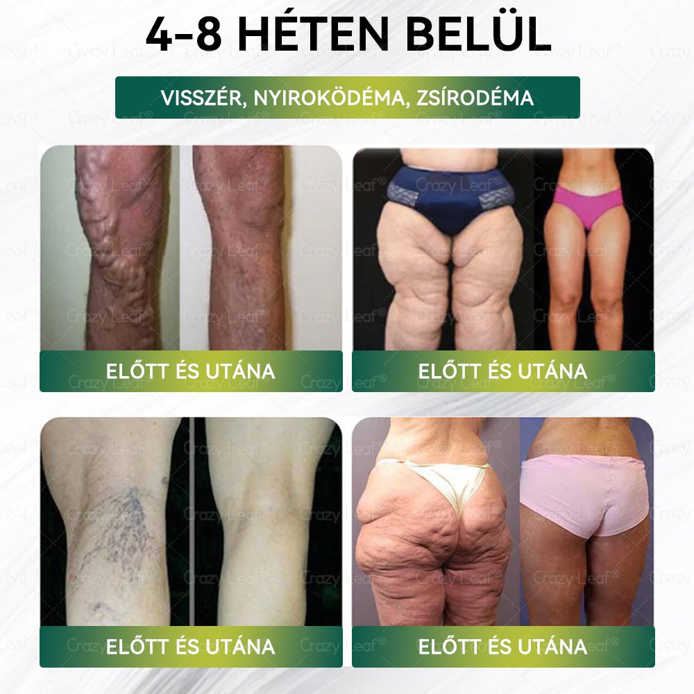 Mayo Klinika által ajánlott | Hivatalos Márkabolt | CrazyLeaf® Meglutide GLP-1 Aktiváló Oralis Oldat – Tartalmaz moringát, NAD+-t és yerba matét, természetes támogatás fogyáshoz, öregedésgátláshoz és cukoranyagcseréhez