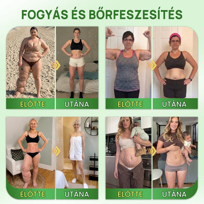 Hivatalos Áruház |🍀BSWELL® Moringa × Berberin × NAD+ 10 az 1-ben Nano Mikrotűs Tapasz (Naponta egyszer, látható változások 7 nap után) ✅ Elhízás, megereszkedett bőr, cukorbetegség, alvási apnoé, ízületi problémák